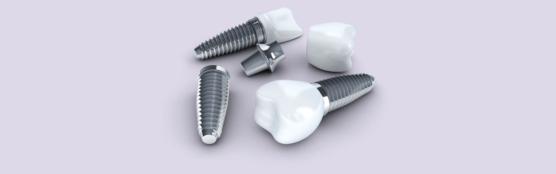 6 Reasons To Consider Dental Implants