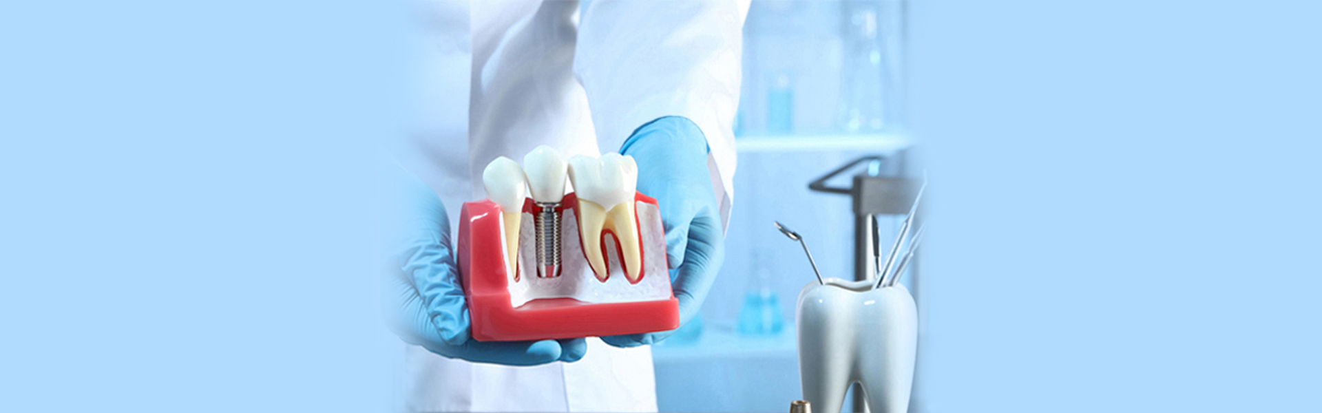 The Impact of Dental Implants on Overall Oral Health and Wellness
