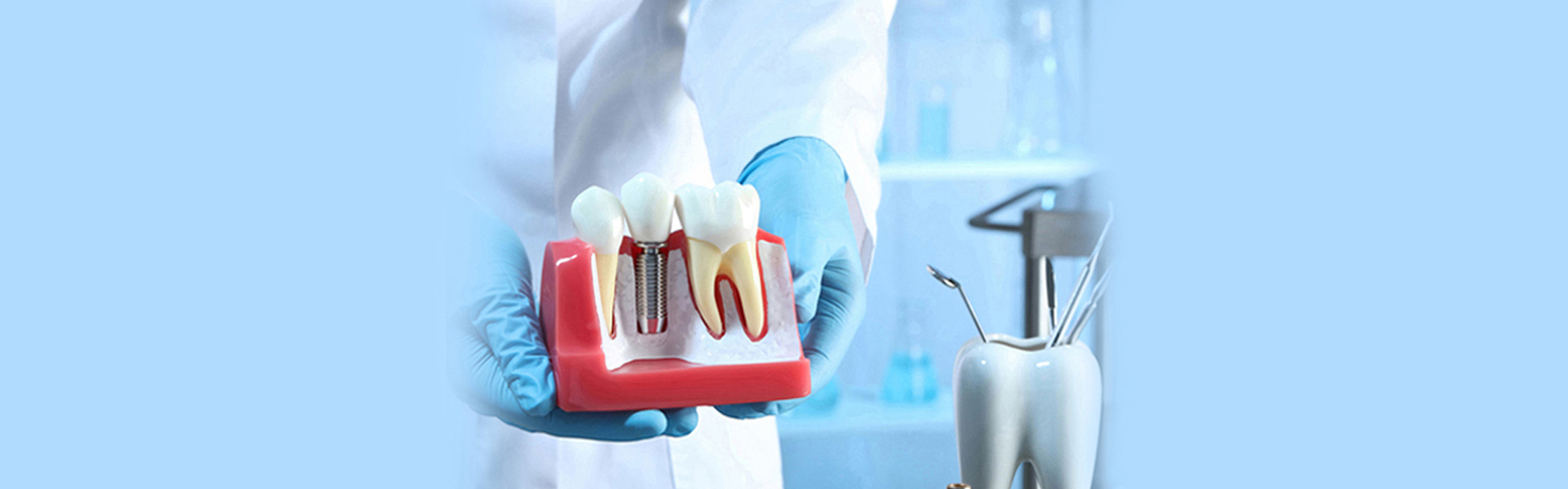 Rediscover Your Best Smile with Implant Crowns: Uses and Benefits Explained