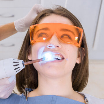 Understanding the Role of Dental Bonding in Aesthetics